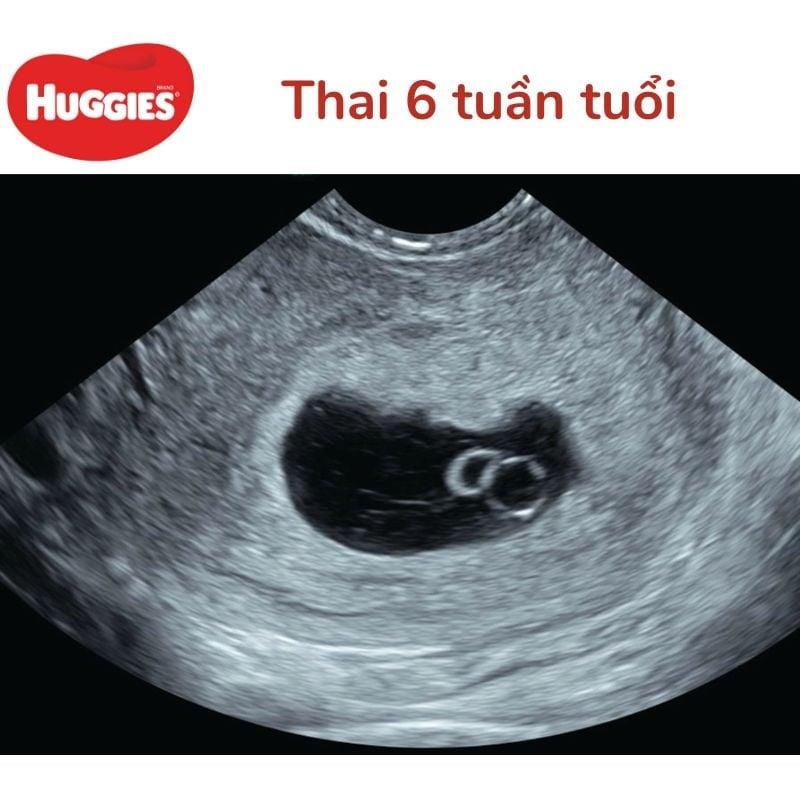 Hinh anh the hien viec cham soc suc khoe me sau sinh mot cach toan dien theo tieu chuan Nhat Ban, bao gom tinh cam va doi song sex me nhat ban